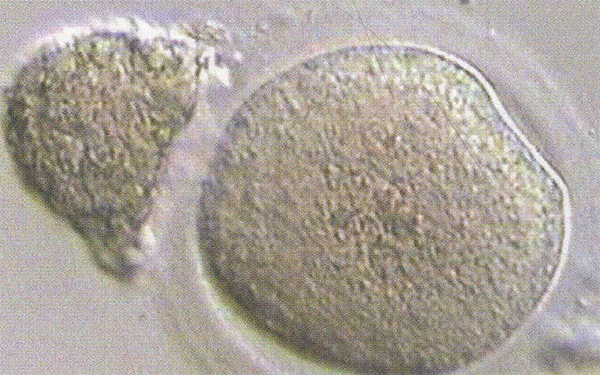 卵子透明带异常可以进行二代试管怀孕