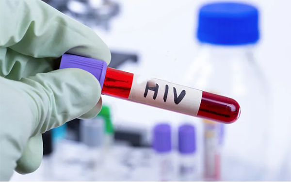 HIV携带患者是不可以在深圳做试管婴儿