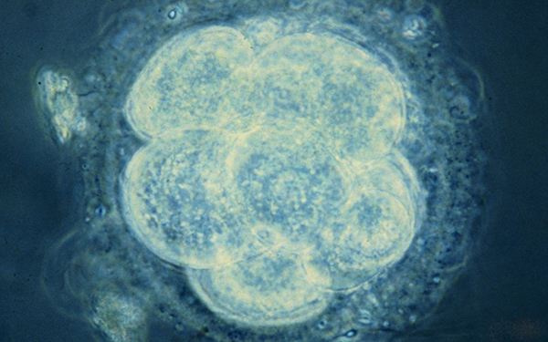 8细胞2级胚胎成功率高