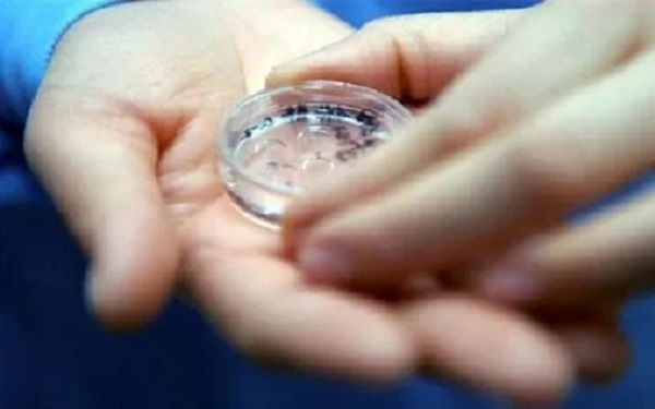 年轻的患者一般建议移植鲜胚