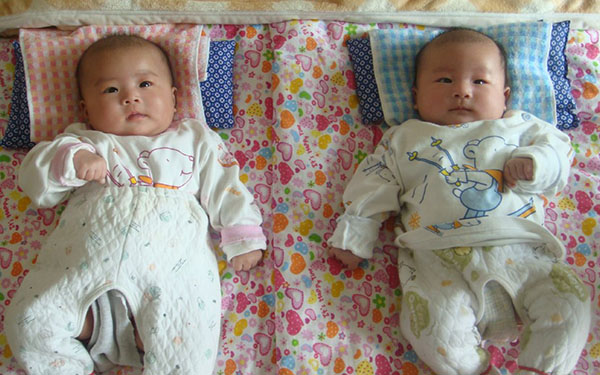 NT看不出双胞胎宝宝的性别