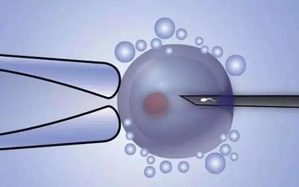 二代试管促排14到15的卵泡不能用于移植