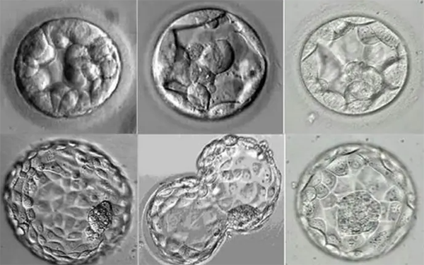 试管促排取卵11个配出来的胚胎分四个等级