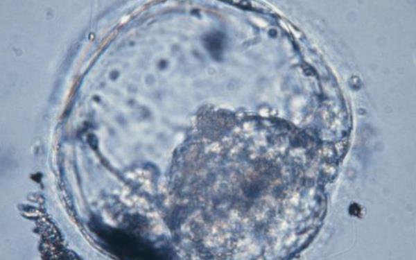 4bb囊胚属于二级胚胎