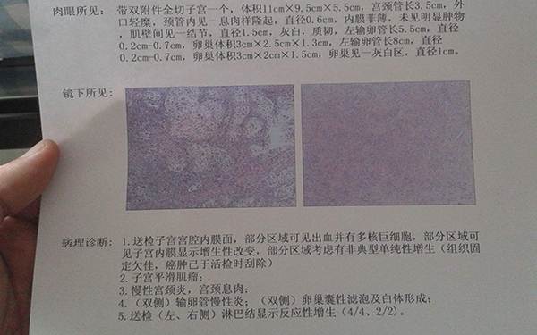 內(nèi)膜轉(zhuǎn)化B到C是說(shuō)明已經(jīng)排卵還是形態(tài)不好？