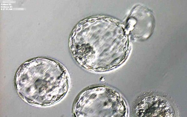 胚胎养囊失败可能不是质量不好