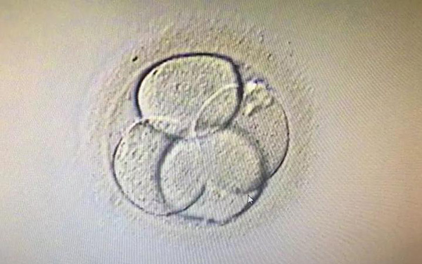 4细胞胚胎养囊成功率低