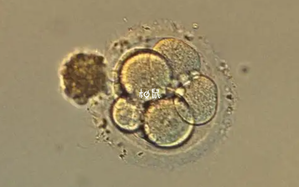 移植2个只存活一个可能是胚胎本身有缺陷