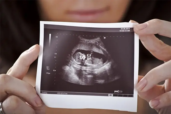 怀孕生男孩女孩的图图片