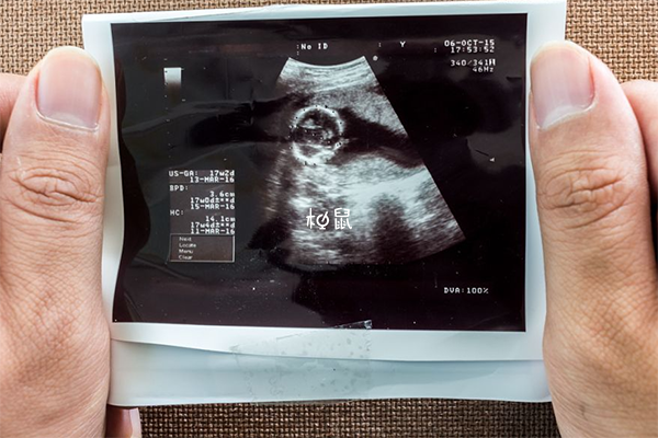 怀孕20周四维彩超图图片