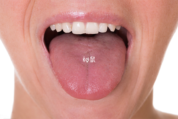 女性怀孕后舌头会有部分变化