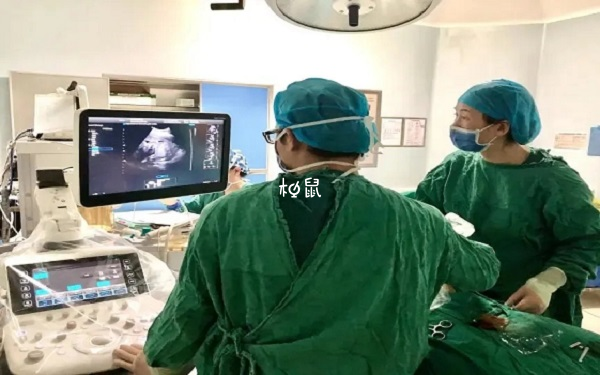 三胎减胎手术成功案例