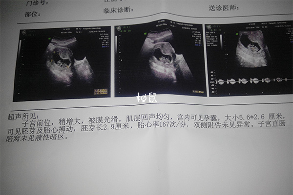 怀孕九周的胎儿如葡萄般大小