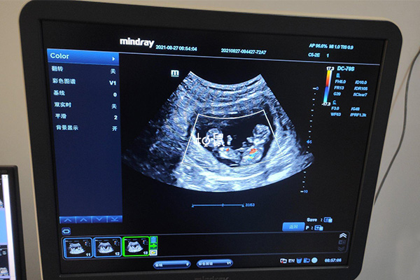 12周胎儿身长为5.3厘米