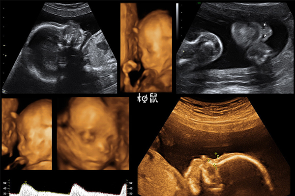 怀孕19周胎儿图图片