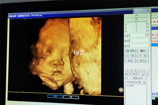 孕27周胎儿体重在900克左右