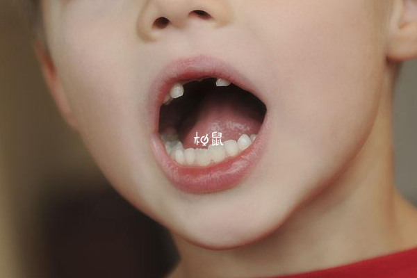 儿童一般最晚12岁换牙