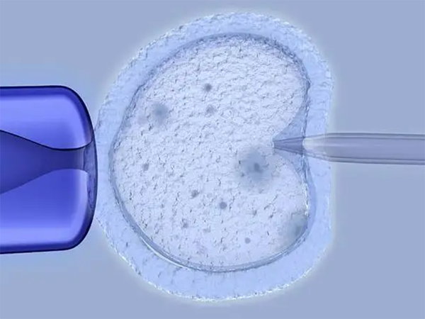 鼻炎对胚胎移植的影响
