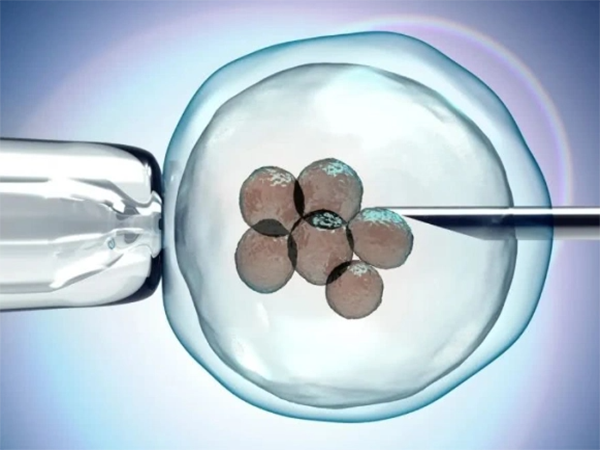 试管婴儿胚胎移植