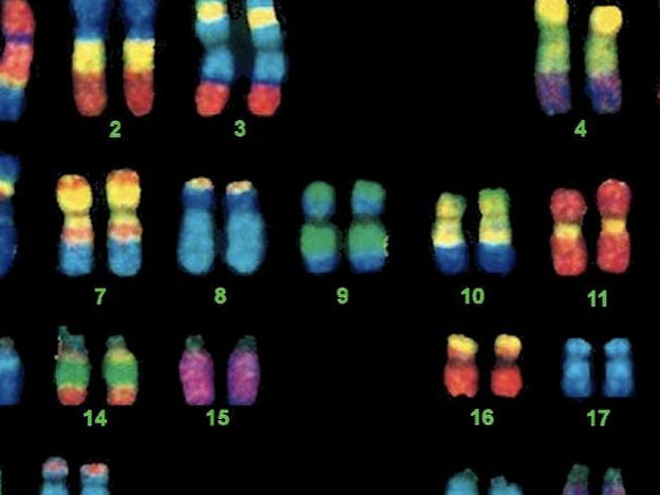 16号染色体异常