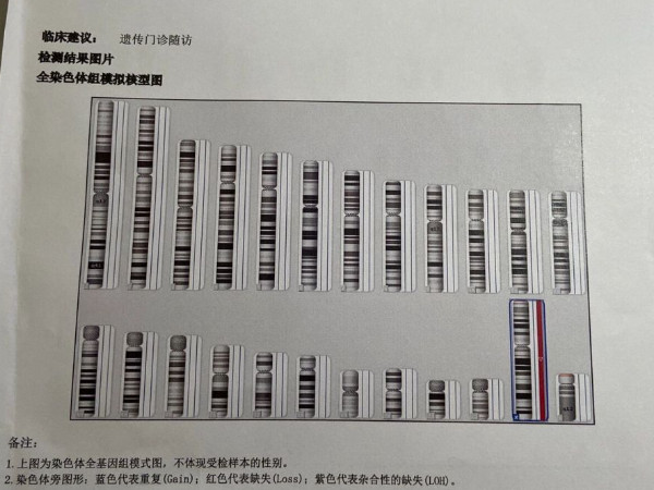 孕期染色体异常检查