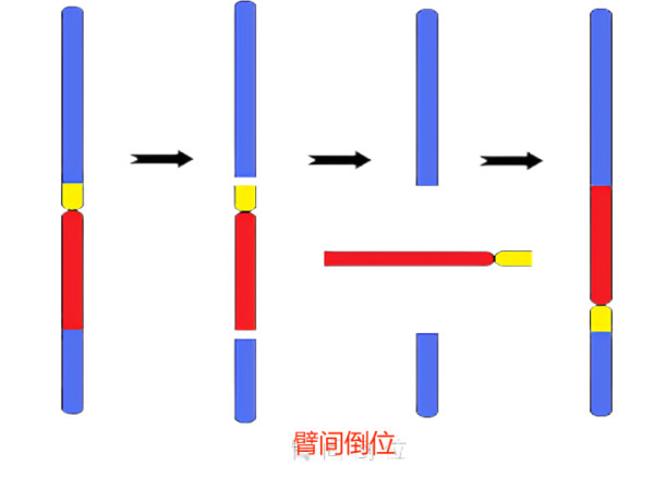 染色体臂间倒位