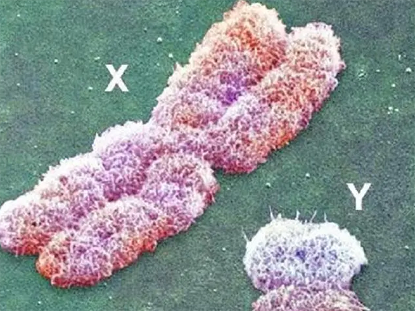 胚胎染色体检查三号染色体多一条是什么情况？