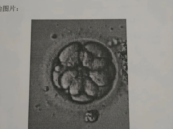胚胎811相当于4aa吗？