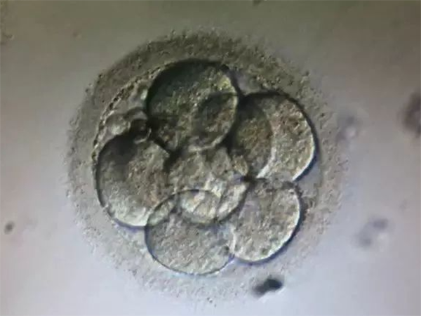 使用辅助孵化技术囊胚多久能着床？