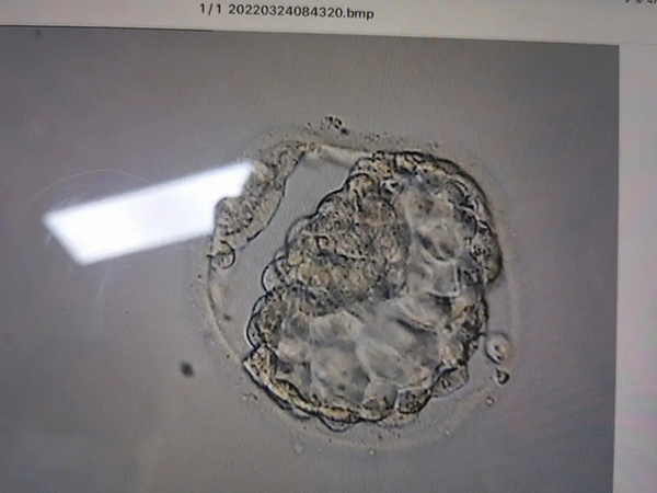 第三天胚胎7细胞？