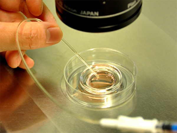 优质囊胚会染色体异常吗？
