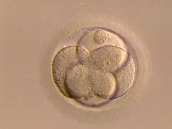0pn囊胚可以移植吗？