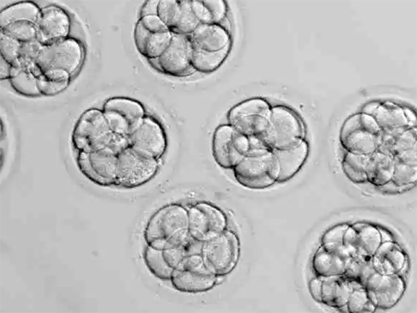 移植两个胚胎会不会两个都失败？