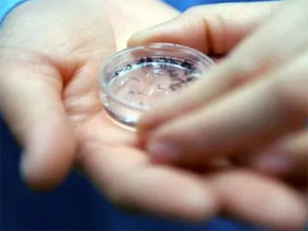 试管移植囊胚多还是鲜胚？