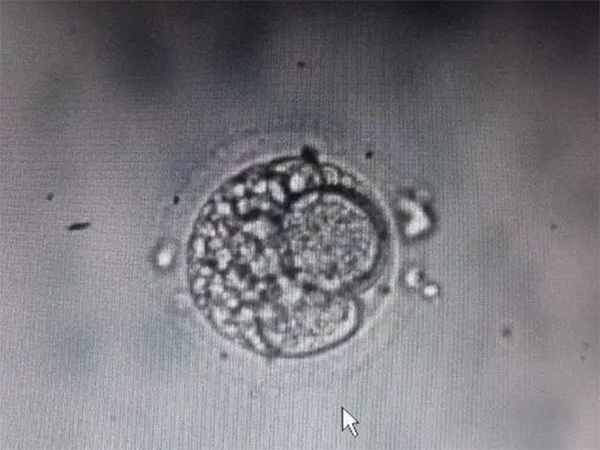 胚胎13c属于几级？