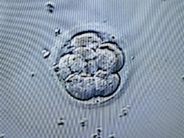 移植3天的胚胎好还是移植4天的？