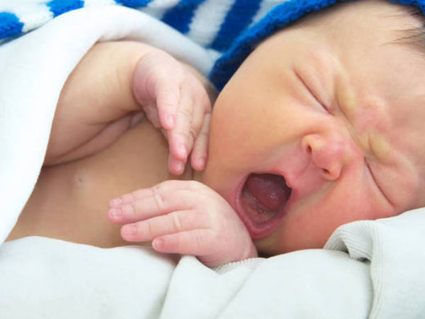 新生儿黄疸的正常范围值是多少