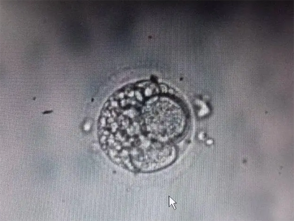 胚胎分数代表什么？
