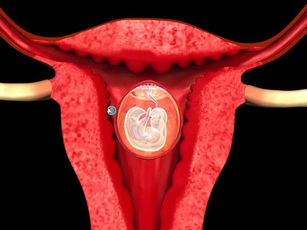 出现宫外孕是不是精子有畸形？