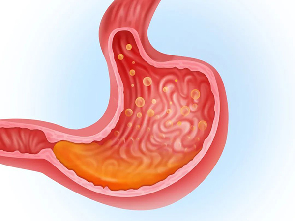 囊胚移植第八天胃酸难受怎么回事？