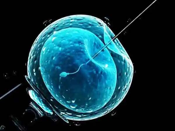 做三代试管后孕早期还需要查染色体吗？