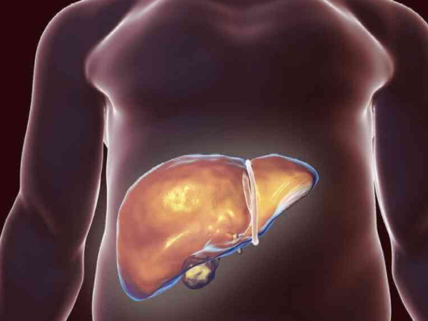 儿童肝脏受损的征兆有哪些