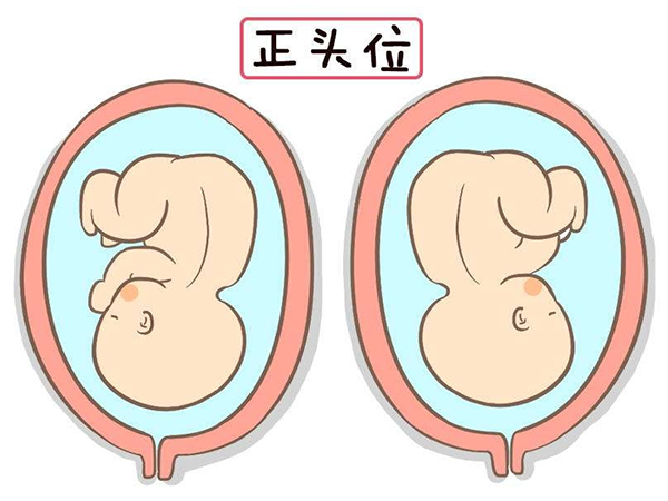 整个孕期一直臀位是不是胎儿有问题？