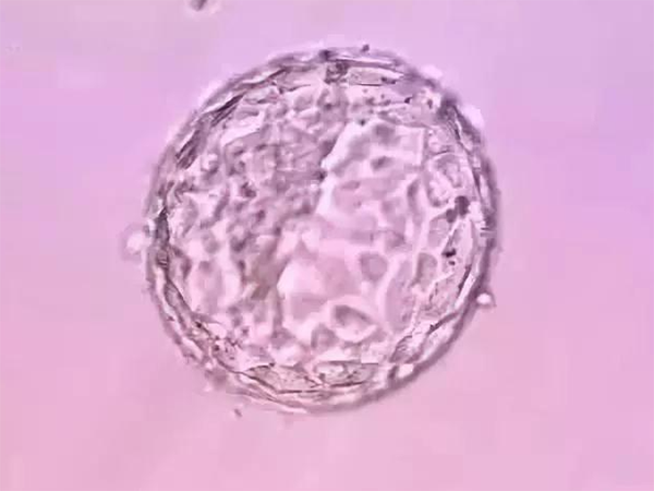移植两颗鲜胚双胎的几率多大？