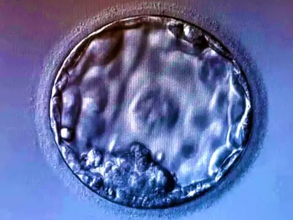 3bb和4bb囊胚的区别