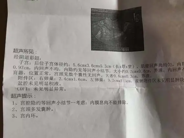 子宫内膜异位症能不能做试管