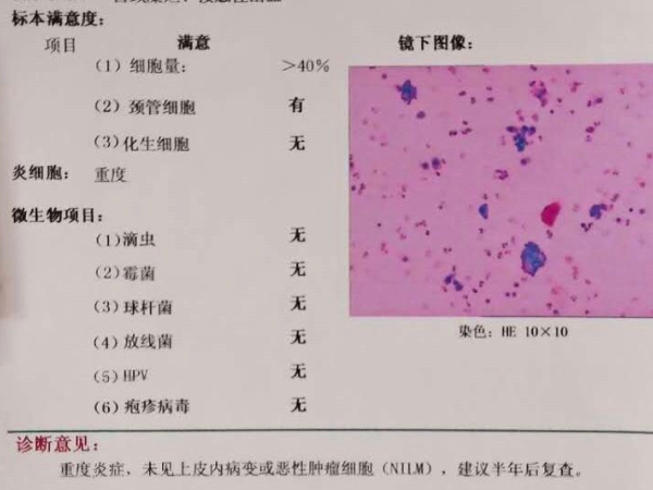 tct项目检查指标