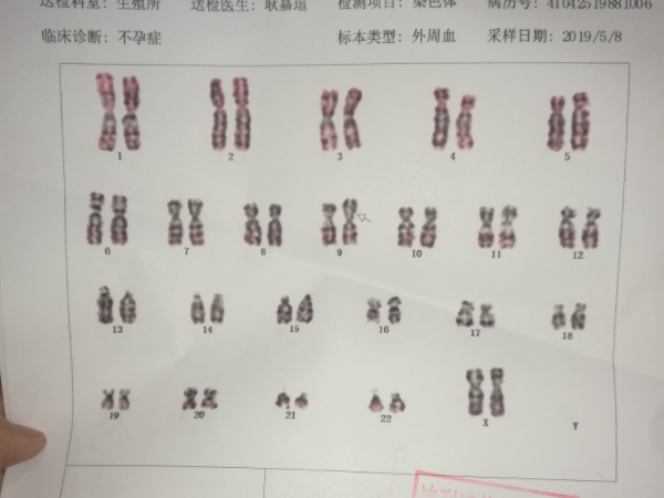 染色体异常能不能做试管