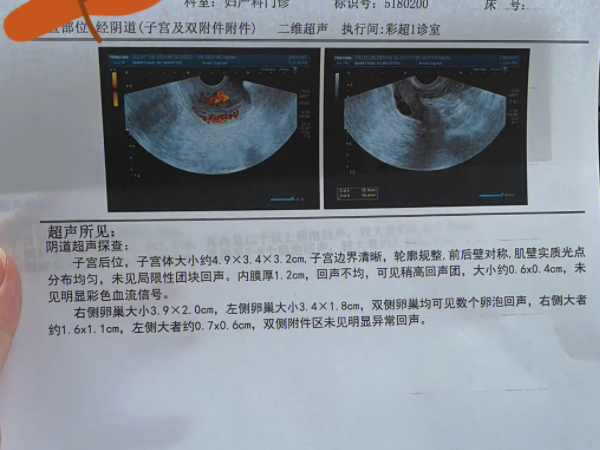 卵泡没破裂能不能怀孕