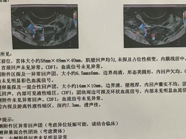 移植后防宫外孕的方法有哪些